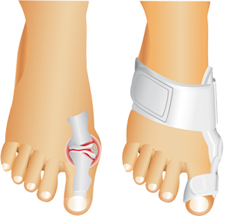 Corector ortopedic pentru deget Active Toe Support