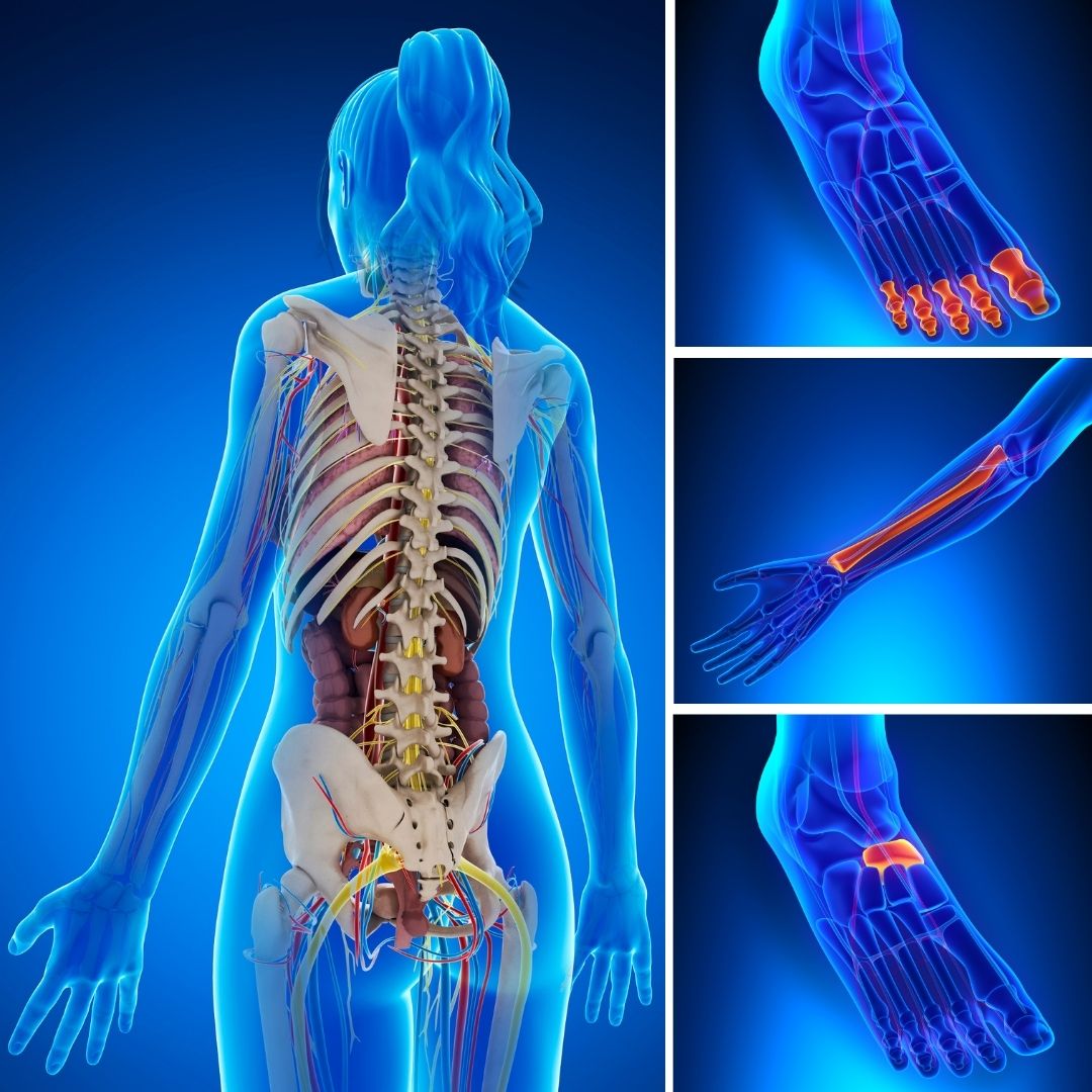 boli ale articulațiilor sistemelor osoase și musculare